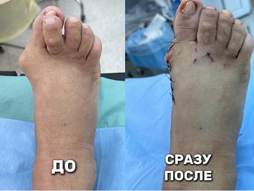 Пациентка 69 лет