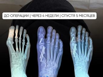 Пациентка 32 года